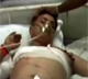maoists attack on congress rally