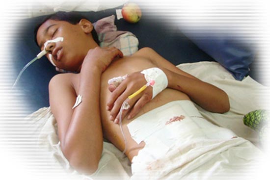 Malegaon blast