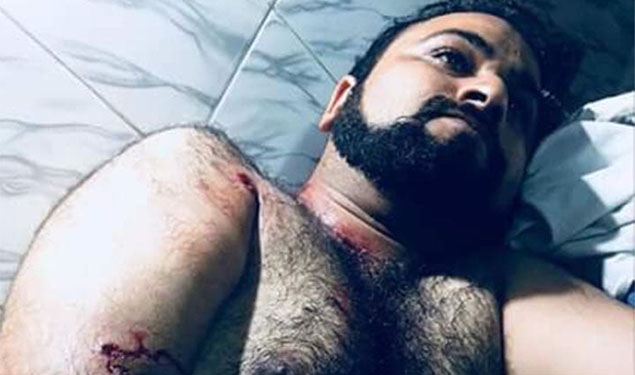 Dr Kafeel's Brother