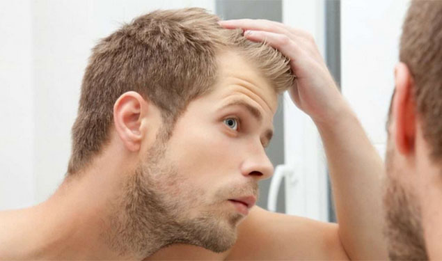 Hair Loss treatment