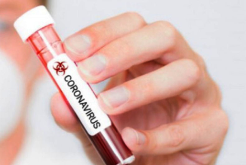 Coronavirus Rajasthan Agewise Report