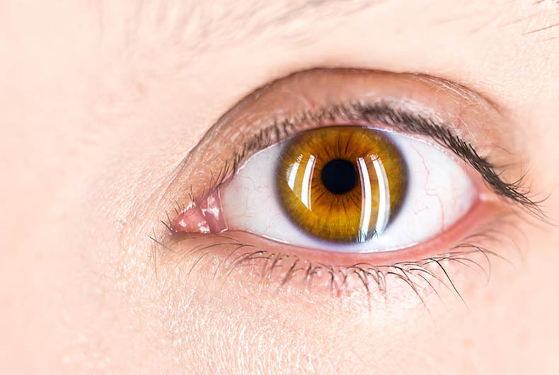 3D Printed Eye