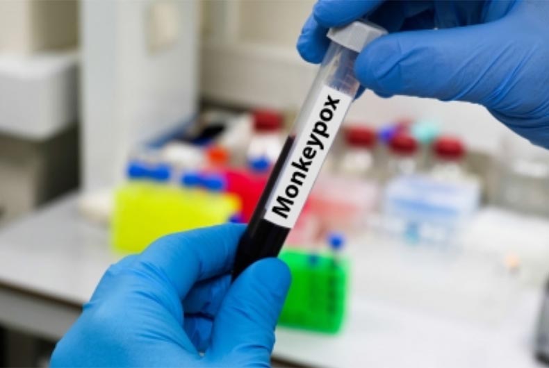 Kerala Monkeypox