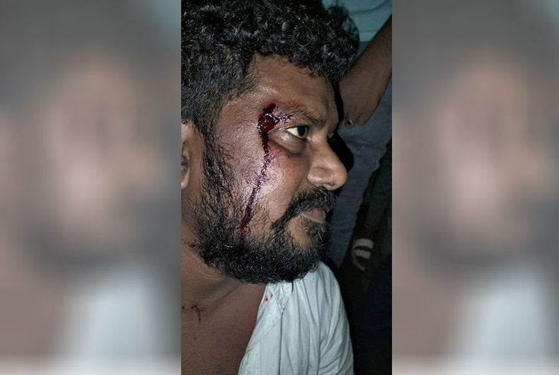 Gujarat: Vansda Cong MLA injured in attack; Supporters run amoke, turn violent