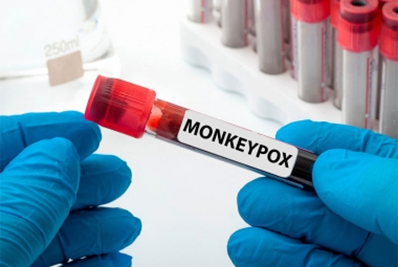 New nanoparticle-based rapid test can detect monkeypox within minutes