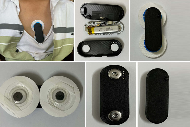 AMU M.Tech student develops portable single lead ECG device