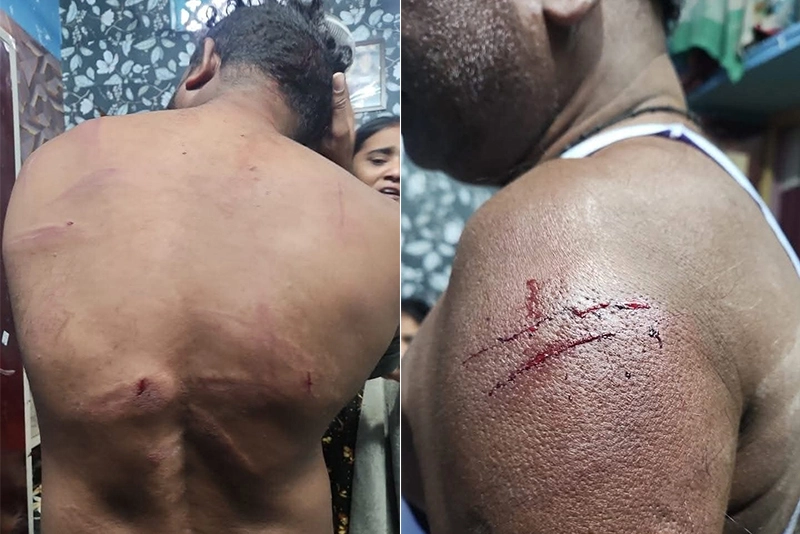 Fact finding team finds widespread police brutality in Prabhani